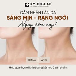 Tẩy Tế Bào Chết Body KyungLab Pure Scrub Premium Care 250ml Dưỡng Da Trắng Sáng Mềm Mịn | Skin Lab 5
