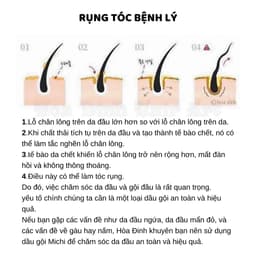 Bộ dầu gội, serum Michi giúp mọc tóc,ngăn rụng,gàu,nấm,ngứa, tẩy da chết da đầu Hàn Quốc 9