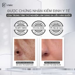 Serum giảm thâm nám và tái tạo da RUÉE Mila Serum Retinol 50ml - Chính hãng Hàn Quốc 5
