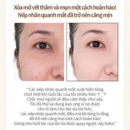 Tinh Chất Keo Ong Wellderma Propolis 1000 Energy Ampoule Hàn Quốc Cải Thiện Nếp Nhăn Lọ 50ml 6