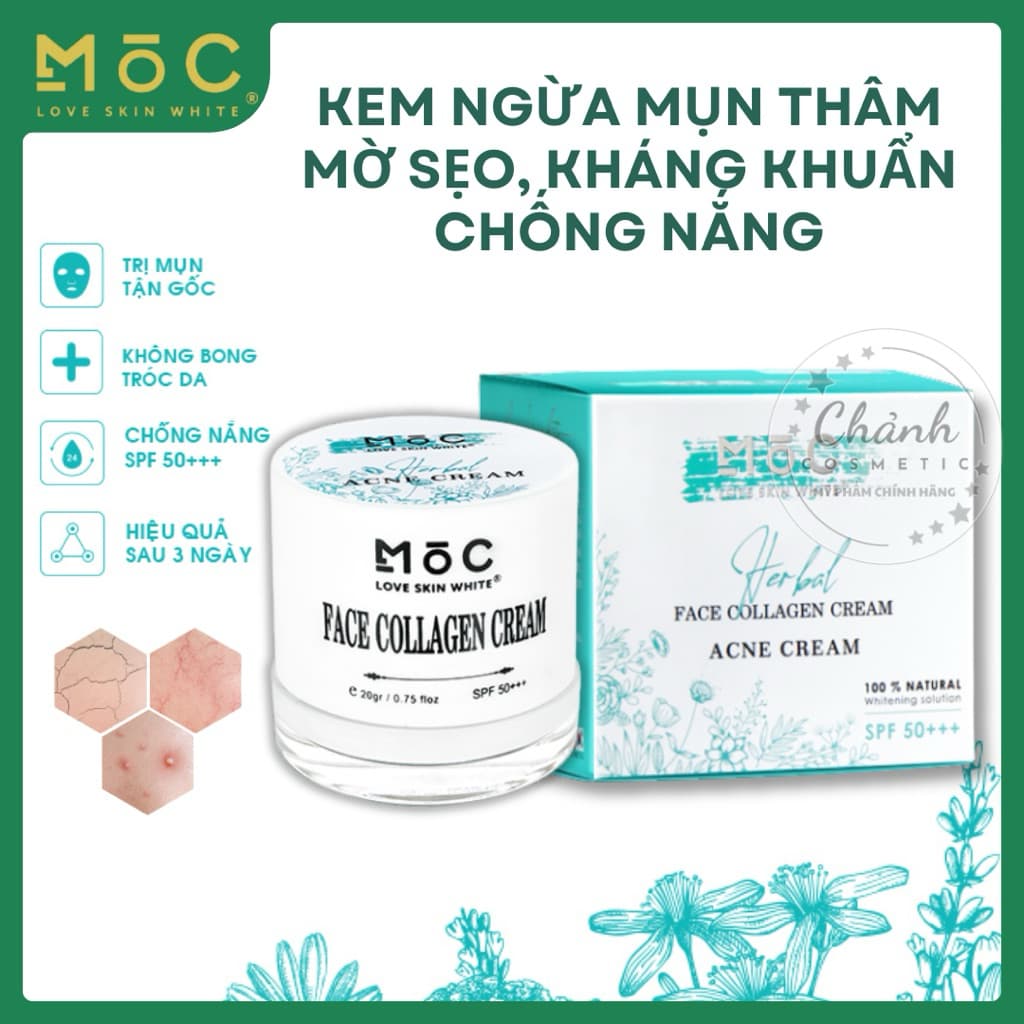 Kem MOC Love Skin White Ngừa Mụn, Mờ Thâm, Trắng Da, Giữ Ẩm, Se Khít Lỗ Chân Lông, Chống Nắng 20gam