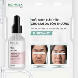 [Đại lý chính hãng] Serum Bionnex B5 Hyaluronic Acid 2% + Artic Algae 30ml | Tinh chất siêu phục hồi cấp ẩm 4