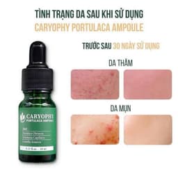 Serum giảm mụn mờ thâm Caryophy Portulaca Ampoule 30ml 8