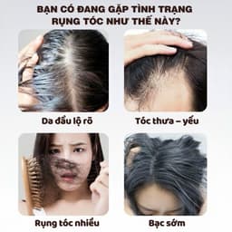 Trà ngũ hắc An Diên, trà thảo mộc hỗ trợ giảm rụng tóc, mọc tóc,  đen tóc, trà bổ khí huyết, mát gan 3