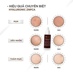 Tinh chất Giảm Thâm Mụn Ekseption Hyaluronic NIACIN Mixlab Serum (HA + 5% B3) 75ml 3