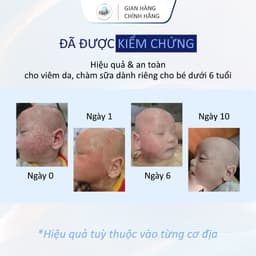 Blue Cap Cream 50g, Kem Bôi Viêm Da Cơ Địa Viêm Da Dị Ứng, Vảy Nến, Giảm Ngứa, Mẩn Đỏ, Dưỡng Ẩm, Làm Dịu Da 6