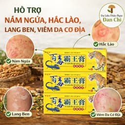 Kem Hổ Vàng chuyên nấm ngứa, hắc lào, mề đay… 2