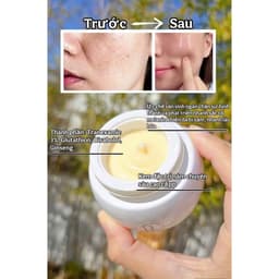 (Công ty) Kem Nám RUEE Dưỡng Trắng Da Ban Đêm Mờ Thâm Nám, Tàn Nhang Hàn Quốc| Cherry Beauty 8
