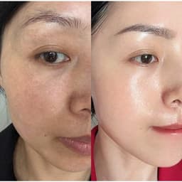 (Công ty) Kem Nám RUEE Dưỡng Trắng Da Ban Đêm Mờ Thâm Nám, Tàn Nhang Hàn Quốc| Cherry Beauty 9