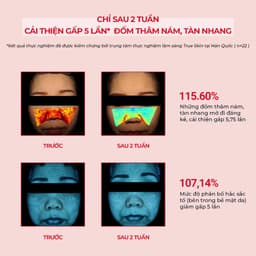 Kem Dưỡng Angel's Liquid Tranexamic Mela Zero Cream 50ml (ĐỎ) Giảm Thâm Nám Chuyên Biệt Skin House 5