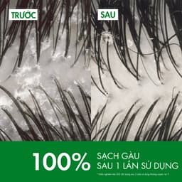 Dầu gội sạch gàu Dercos VICHY 100% chỉ sau 1 lần gội dành cho da dầu & ngứa 200ml SKINCARESHOP 4