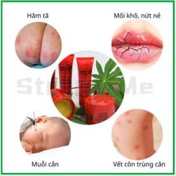 Lucas' Papaw Kem Dưỡng Đa Năng 25g- Chiết Xuất Đu Đủ Tự Nhiên,Giảm Khô Nứt & Sưng Viêm, Dưỡng Ẩm & Làm Mềm Da 2