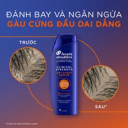 Dầu Gội HEAD & SHOULDERS Clinical Strength 4X Sức Mạnh Dành Cho Da Đầu Khô Chai 400ml SKINCARESHOP 4