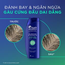 [KOL] Combo 2 Dầu Gội Làm Sạch Và Ngăn Ngừa Gàu Nấm HEAD & SHOULDERS Clinical Strength Cho Da Đầu Khô/ Ngứa/ Dầu 5