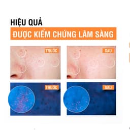 Sữa Rửa Mặt Neutrogena Deep Clean Blackhead Eliminating Daily Scrub 100g 5