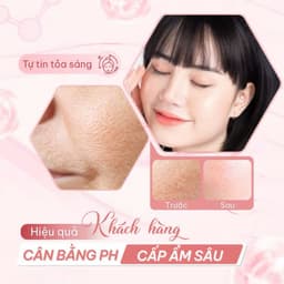 [S-VIP] Toner Sạch Sâu Hỗ Trợ Giảm Mụn, Mờ Thâm,Sáng Da Compliment Facial Glycolic Acid, AHA/BHA Acids 200ml 7