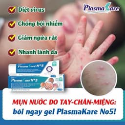 Tuýp bôi Plasma Kare NO5 giúp giảm viêm da cơ địa , giảm nấm ngứa , viên da dị ứng< BUNBUN SHOP 3