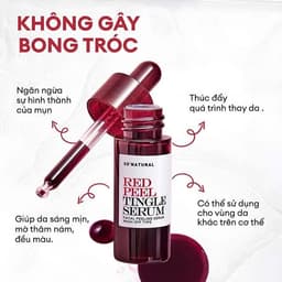 (Công ty) Tinh Chất Red Peel Tingle Serum So’Natural Trắng Da Đều Màu, Cải Thiện Lỗ Chân Lông| Cherry Beauty 5