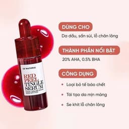 (Công ty) Tinh Chất Red Peel Tingle Serum So’Natural Trắng Da Đều Màu, Cải Thiện Lỗ Chân Lông| Cherry Beauty 6