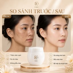 Kem Nám Ban Đêm RUÉE Mela Cream 50ml – Mờ Nám, Tàn Nhang, Thâm Sạm, Đều Màu Da, Dưỡng Ẩm Phục Hồi 8