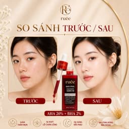 Serum Peel Da RUÉE Red Peel Whitening Serum 30ml - Tẩy Tế Bào Chết, Làm Sáng Da, Giảm Mụn 7