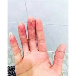 Kem Nobason 30gr Hàn Quốc Thoa Da Khô, Á Sừng, Chàm Nứt Nẻ Chân Tay 3