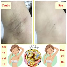 Kem Cô Bơ Hỗ Trợ Dưỡng Nách , Hôi Nách, Thâm Nách 4