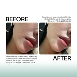 Tế Bào Gốc Chống Lão Hóa, Xử Lý Sẹo Rỗ GSC Anti Ageing Ampoule Tăng Sinh Collagen, Phục Hồi Da Peel 10ml - GB023A 4