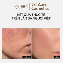 Kem dưỡng TRANSPARENT CERAMIDE REPAIR MOISTURIZER phục hồi, dưỡng ẩm da 30ml 8