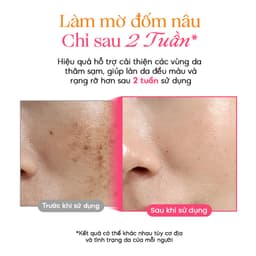 Tinh chất hỗ trợ dưỡng sáng và tái tạo da PURITO TXA Niacinamide 10 Retinal Serum 30ml 5