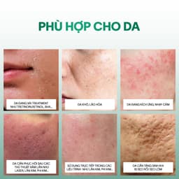 [MUA 04 TẶNG 01] Tế Bào Gốc Xử Lý Sẹo, Trẻ Hóa Da GSC GA Anti Ageing Ampoule 6