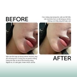 [MUA 04 TẶNG 01] Tế Bào Gốc Xử Lý Sẹo, Trẻ Hóa Da GSC GA Anti Ageing Ampoule 8