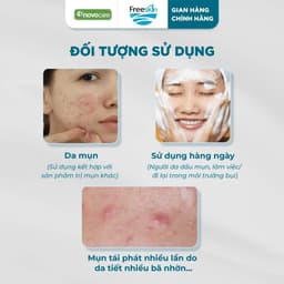 Bọt rửa mặt cho da dầu mụn Freeskin - Novocare - Làm sạch sâu, hỗ trợ giảm mụn và bã nhờn, không gây khô căng da 120ml 5
