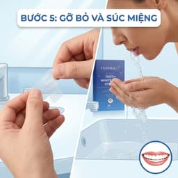 Miếng dán trắng răng trắng nhanh không gây ê buốt phù hợp với mọi men răng 6