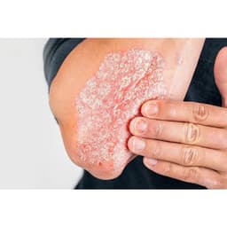 [Đánh giá] Đại tràng Tâm Bình - Hỗ trợ giảm triệu chứng của viêm đại tràng cấp và mạn tính, đau bụng, đầy hơi, tiêu chảy 8