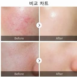 [Chính hãng] Mặt nạ Phục Hồi Tái Sinh KR.LAB B5 Niacinamide EGF Complex Mask 3