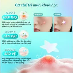 Miếng Dán Mụn Lanbena Invisible Acne Pimple Patch Day Use Ban Ngày 36 Miếng Hình Sao và Trái Tim 3