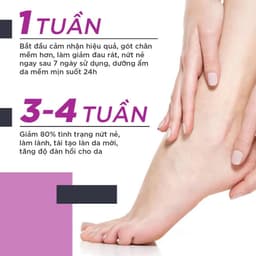 Kem nứt gót và dưỡng da chân tay Oriss tinh chất nghệ và trầu không tái tạo làm hồng gót Tuýp 30gr 3