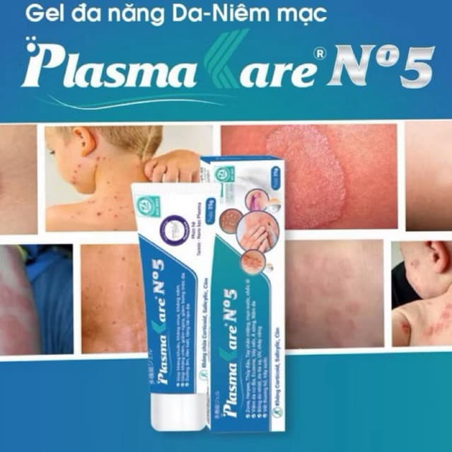 Tuýp bôi Plasma Kare NO5 giúp giảm viêm da cơ địa , giảm nấm ngứa , viên da dị ứng