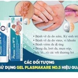 Tuýp bôi Plasma Kare NO5 giúp giảm viêm da cơ địa , giảm nấm ngứa , viên da dị ứng 2