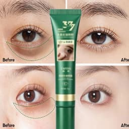 Kem Mắt 20g YaPing 377 Dưỡng Mắt Giảm Nhăn, Mờ Thâm Quầng, Tan Bọng Mắt  6