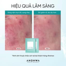 Mặt nạ giấy sinh học phục hồi vitamin K Ahohwa Vitamin K Calming Sheet Mask 7