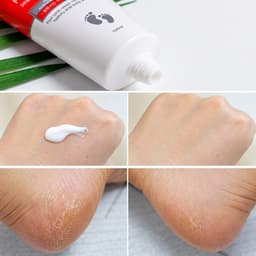 Kem Dưỡng Da Chân, Dưỡng Ẩm Gót Chân 3W CLINIC ENRICH FOOT TREATMENT 100ML 3