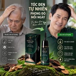 Dầu gội phủ bạc 2 màu đen & nâu Thảo mộc _xanh_X4 4