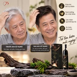 Dầu gội phủ bạc 2 màu đen & nâu Thảo mộc _xanh_X4 5