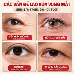 Cây lăn massage mắt mini 5 bi đồng thân gỗ nhỏ gọn giảm sưng, thư giãn vùng mắt hiệu quả 5