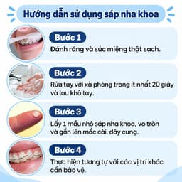 Sáp nha khoa , sáp giảm đau, không mùi cho người niềng răng chỉnh nha 2