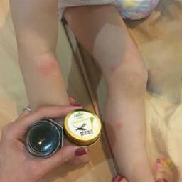 Kem Bôi Muỗi Đốt Thái Lan Chính Hãng Cho Bé Và Người Lớn Làm Dịu Vết Muỗi Đốt Côn Trùng 6