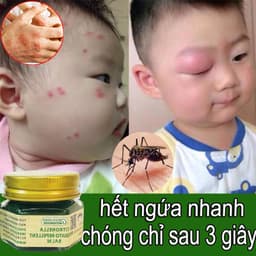 Kem Bôi Muỗi Đốt Thái Lan Chính Hãng Cho Bé Và Người Lớn Làm Dịu Vết Muỗi Đốt Côn Trùng 5