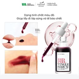(Công ty) Tinh Chất Red Peel Tingle Serum So’Natural Trắng Da Đều Màu, Cải Thiện Lỗ Chân Lông| Cherry Beauty 3